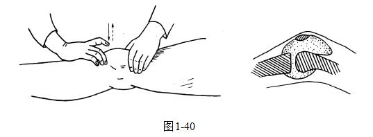 152. 检查膝关节屈曲运动153. 检查髌阵挛(见图1-41)受检者下肢伸直,检查